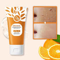 🍊✨ Orange Brightening Exfoliating Gel ✨🍊
